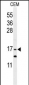 GMFG Antibody (C-term)
